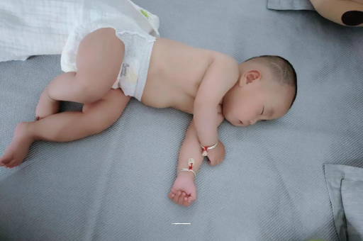 铜陵宝宝头上长痱子